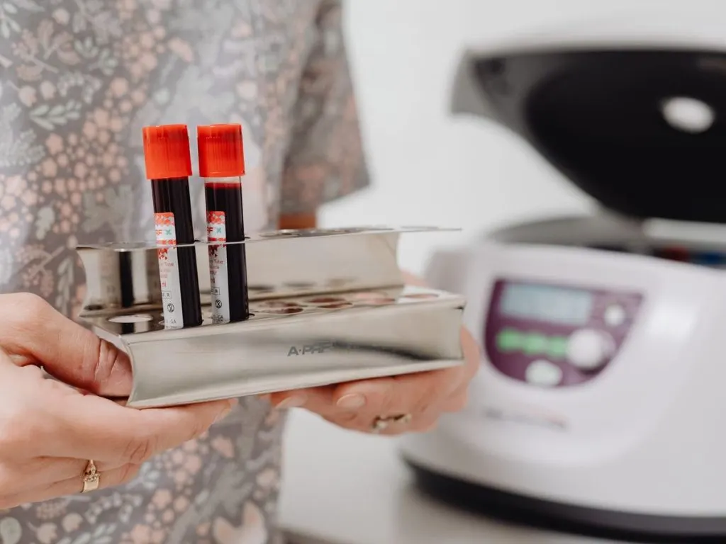 Tubes de prélèvement sanguin tenus devant une centrifugeuse de laboratoire